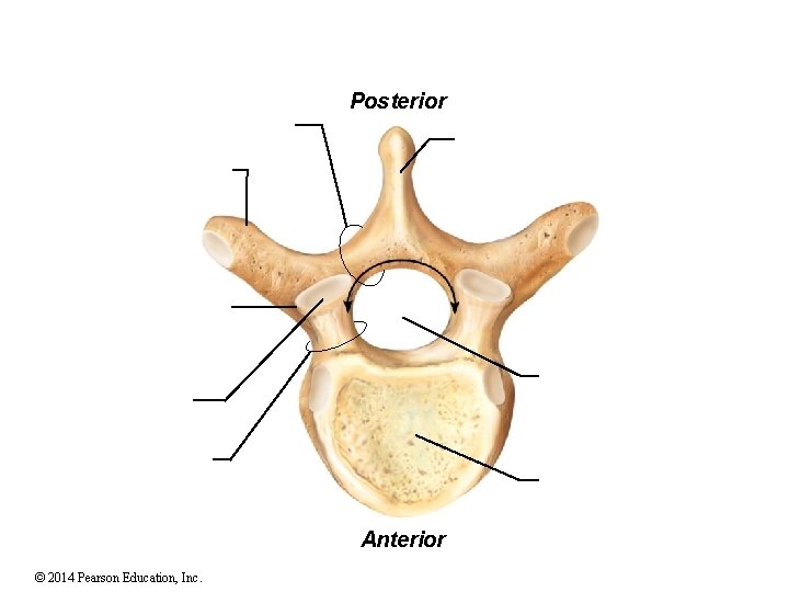 Posterior Anterior © 2014 Pearson Education, Inc. 