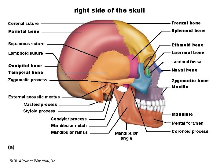 right side of the skull Coronal suture Frontal bone Parietal bone Sphenoid bone Squamous