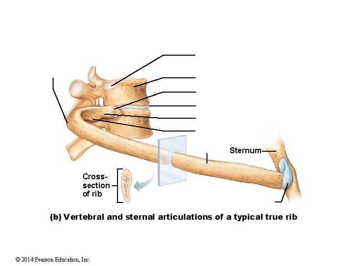 Sternum Crosssection of rib Vertebral and sternal articulations of a typical true rib ©