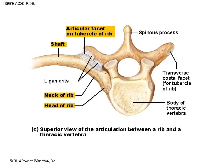 Figure 7. 25 c Ribs. Articular facet on tubercle of rib Spinous process Shaft