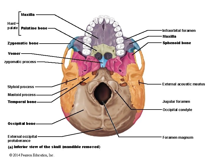 Maxilla Hard palate Palatine bone Infraorbital foramen Maxilla Zygomatic bone Sphenoid bone Vomer zygomatic