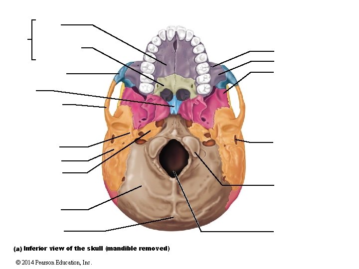 Inferior view of the skull (mandible removed) © 2014 Pearson Education, Inc. 