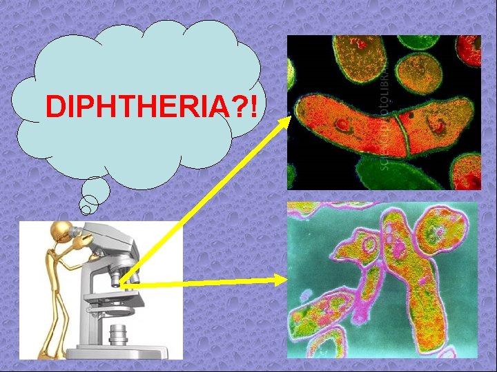 DIPHTHERIA? ! 