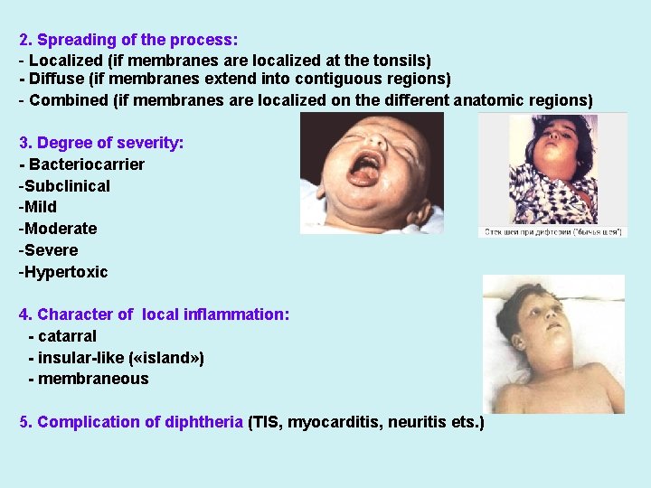 2. Spreading of the process: - Localized (if membranes are localized at the tonsils)