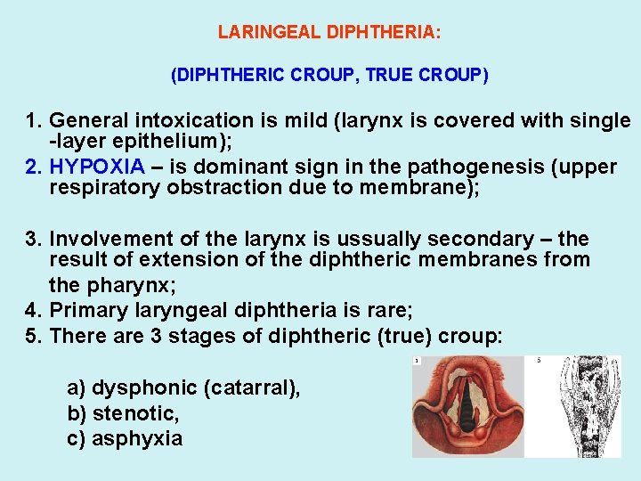 LARINGEAL DIPHTHERIA: (DIPHTHERIC CROUP, TRUE CROUP) 1. General intoxication is mild (larynx is covered