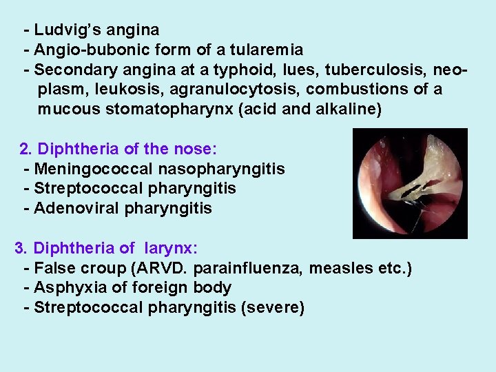 - Ludvig’s angina - Аngio-bubonic form of a tularemia - Secondary angina at a