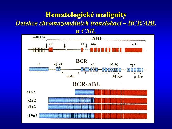 Hematologické malignity Detekce chromozomálních translokací – BCR/ABL u CML 