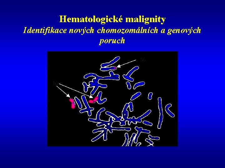 Hematologické malignity Identifikace nových chomozomálních a genových poruch 