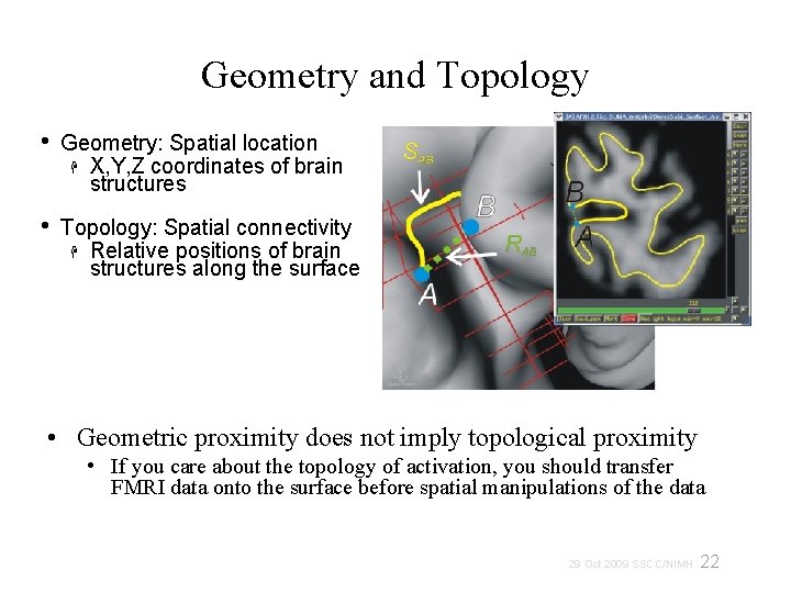 Geometry and Topology • Geometry: Spatial location X, Y, Z coordinates of brain structures