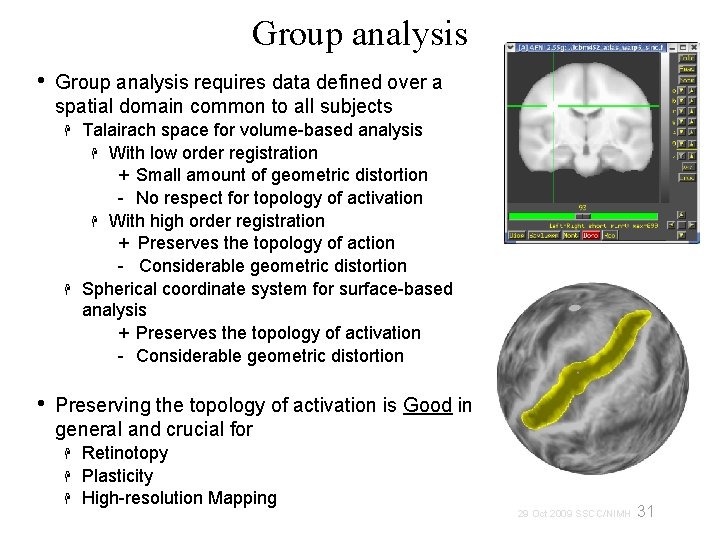 Group analysis • Group analysis requires data defined over a spatial domain common to