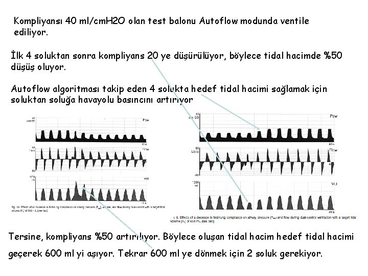 Kompliyansı 40 ml/cm. H 2 O olan test balonu Autoflow modunda ventile ediliyor. İlk