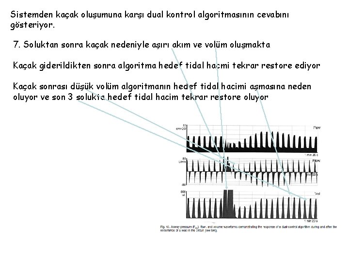 Sistemden kaçak oluşumuna karşı dual kontrol algoritmasının cevabını gösteriyor. 7. Soluktan sonra kaçak nedeniyle