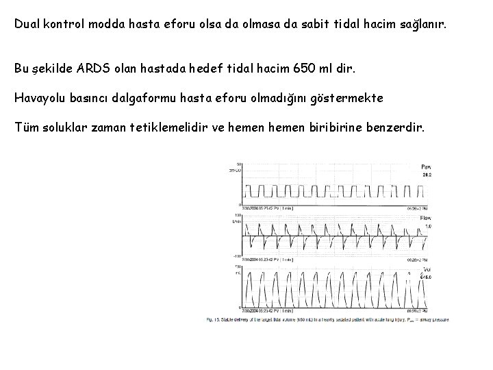 Dual kontrol modda hasta eforu olsa da olmasa da sabit tidal hacim sağlanır. Bu