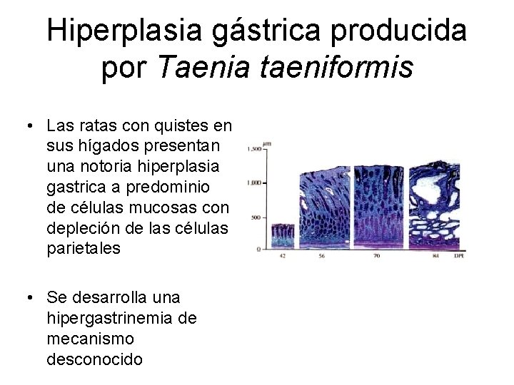 Hiperplasia gástrica producida por Taenia taeniformis • Las ratas con quistes en sus hígados