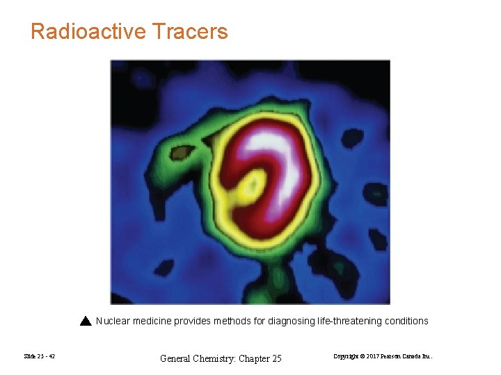 Radioactive Tracers Nuclear medicine provides methods for diagnosing life-threatening conditions Slide 25 - 42