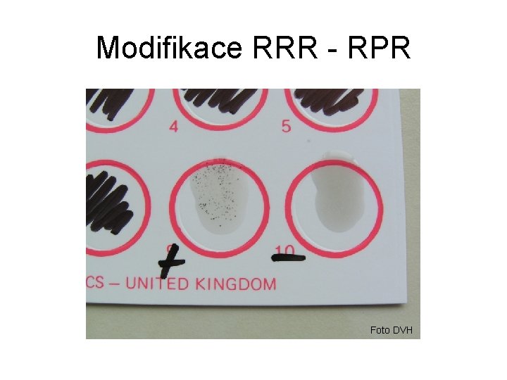 Modifikace RRR - RPR Foto DVH 