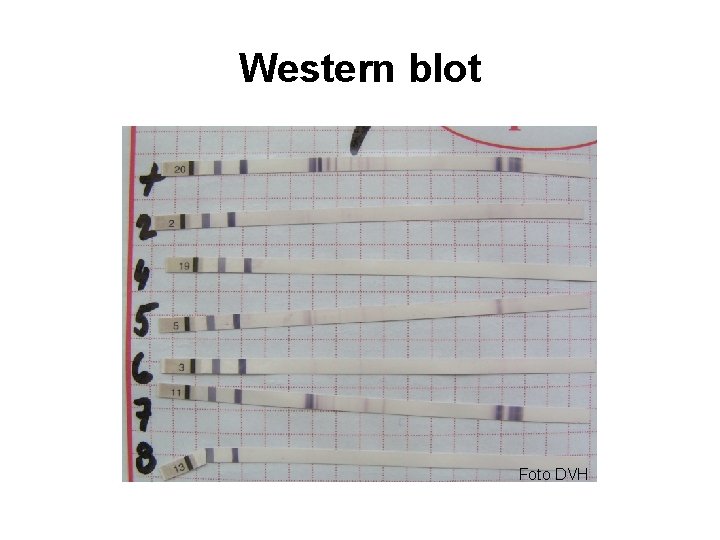 Western blot Foto DVH 