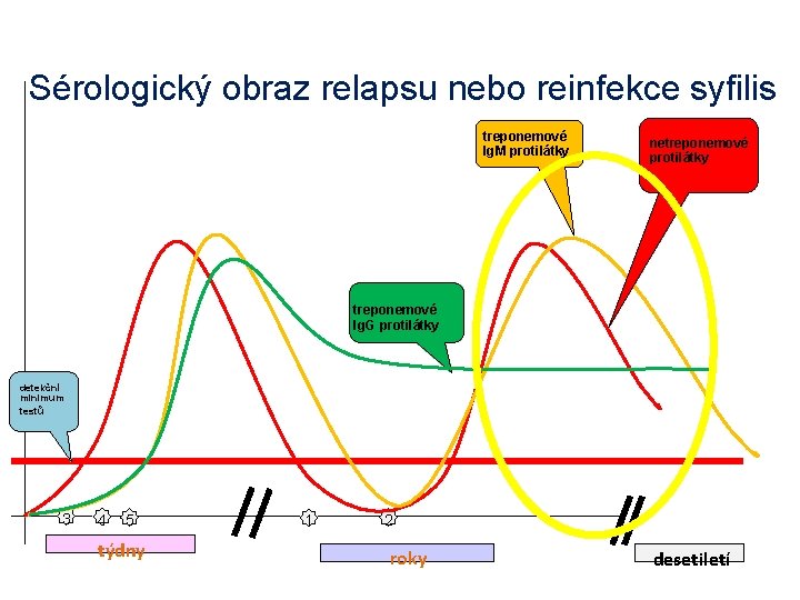 Sérologický obraz relapsu nebo reinfekce syfilis treponemové Ig. M protilátky netreponemové protilátky treponemové Ig.