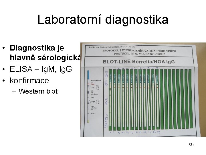 Laboratorní diagnostika • Diagnostika je hlavně sérologická • ELISA – Ig. M, Ig. G