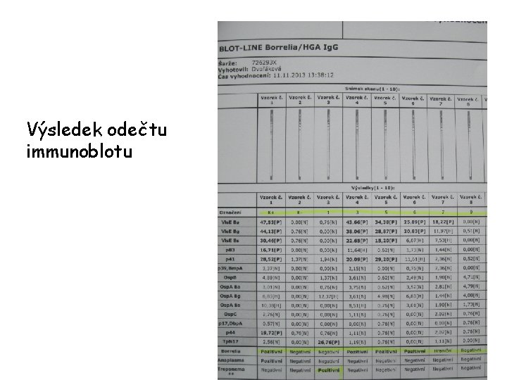 Výsledek odečtu immunoblotu 96 