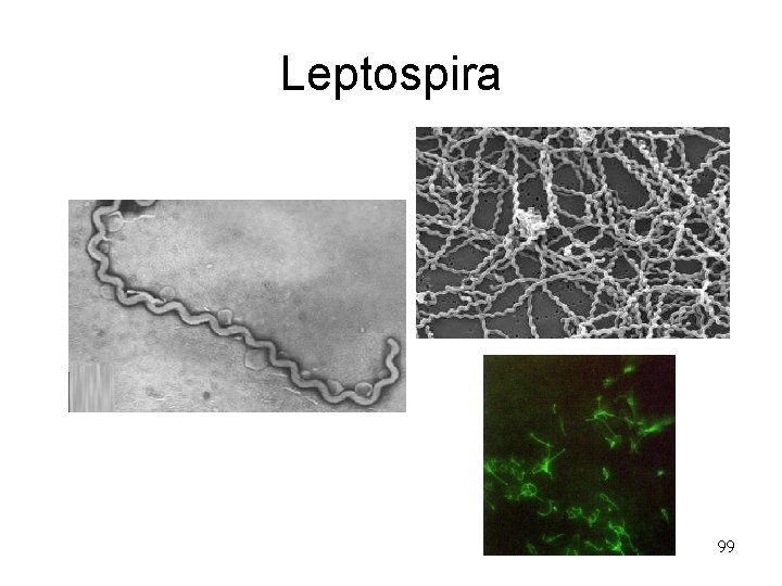 Leptospira 99 