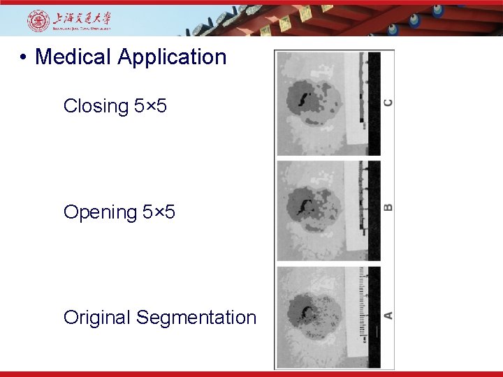  • Medical Application Closing 5× 5 Opening 5× 5 Original Segmentation 