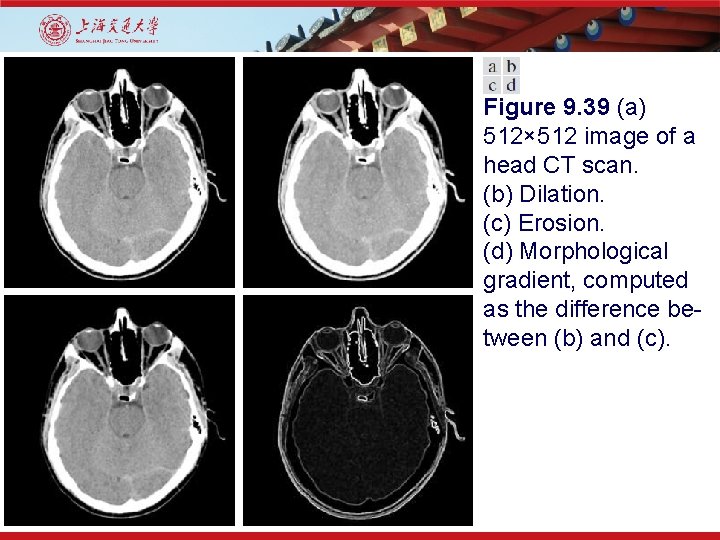 Figure 9. 39 (a) 512× 512 image of a head CT scan. (b) Dilation.