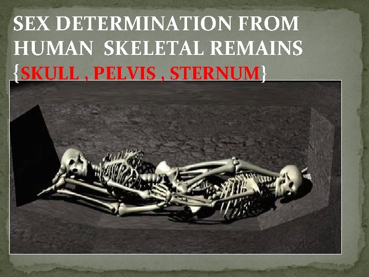 SEX DETERMINATION FROM HUMAN SKELETAL REMAINS {SKULL , PELVIS , STERNUM} 