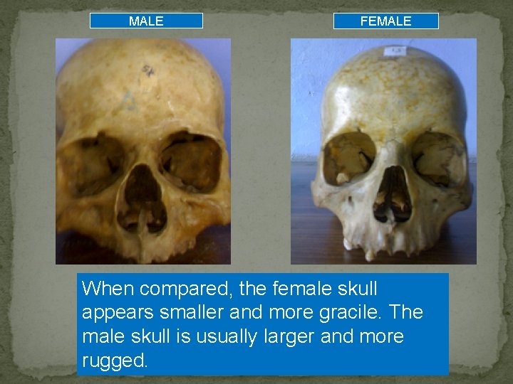 MALE FEMALE When compared, the female skull appears smaller and more gracile. The male