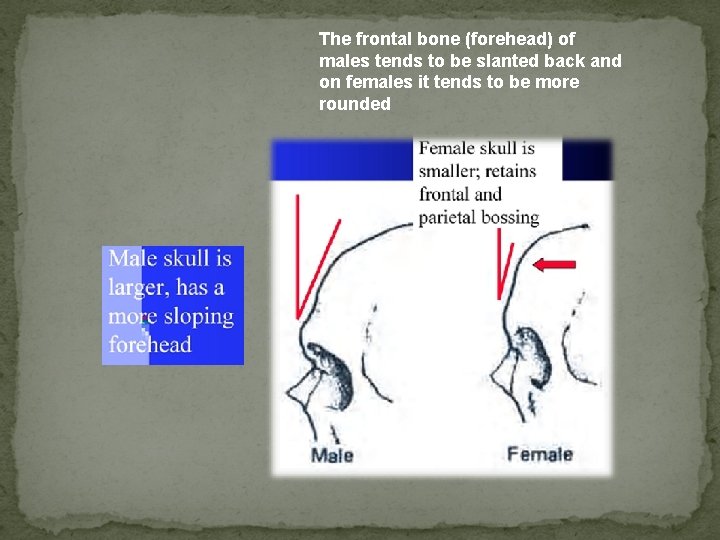 The frontal bone (forehead) of males tends to be slanted back and on females