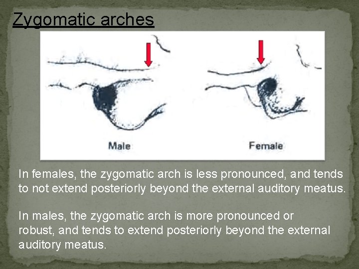 Zygomatic arches In females, the zygomatic arch is less pronounced, and tends to not