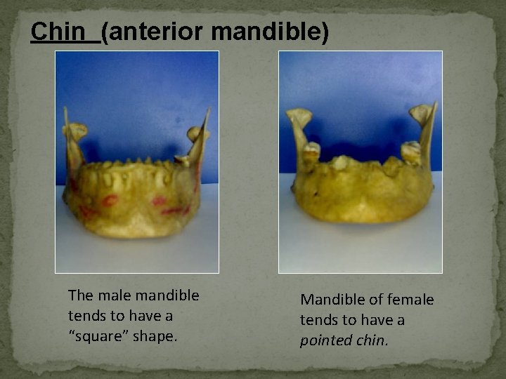 Chin (anterior mandible) The male mandible tends to have a “square” shape. Mandible of