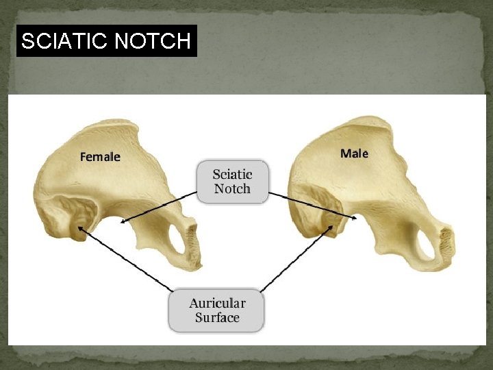 SCIATIC NOTCH 