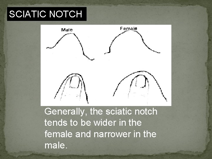 SCIATIC NOTCH Generally, the sciatic notch tends to be wider in the female and