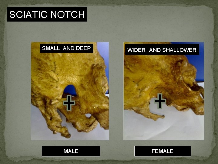 SCIATIC NOTCH SMALL AND DEEP MALE WIDER AND SHALLOWER FEMALE 