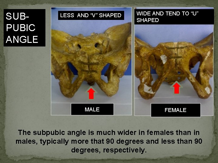 SUBPUBIC ANGLE LESS AND “V” SHAPED MALE WIDE AND TEND TO “U” SHAPED FEMALE