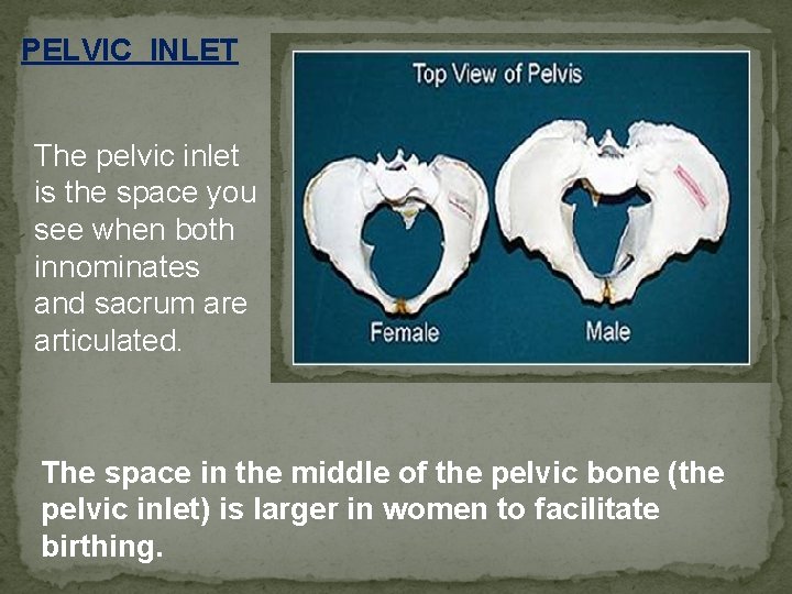 PELVIC INLET The pelvic inlet is the space you see when both innominates and