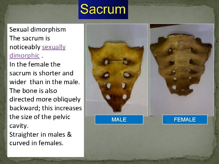 Sexual dimorphism The sacrum is noticeably sexually dimorphic. In the female the sacrum is