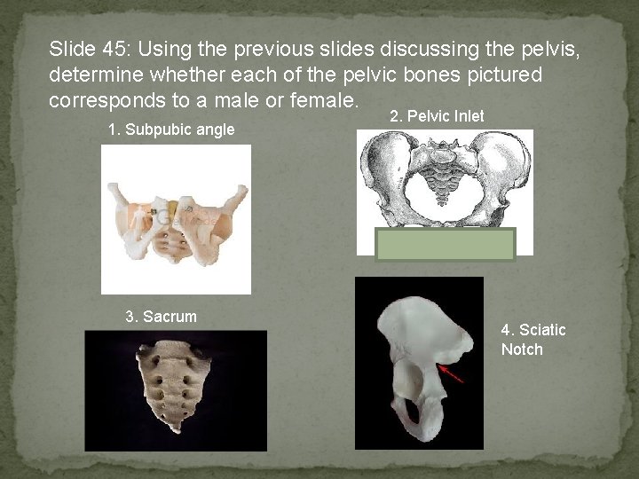 Slide 45: Using the previous slides discussing the pelvis, determine whether each of the