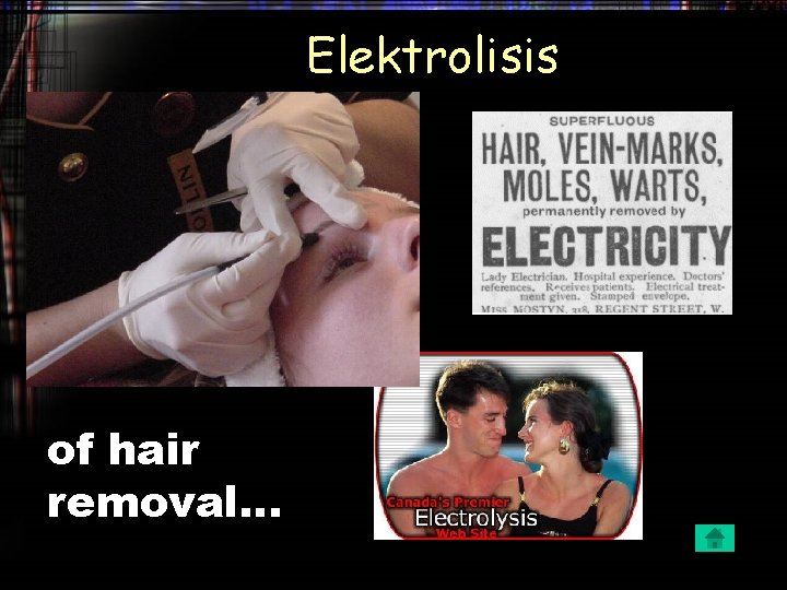 Elektrolisis of hair removal… 