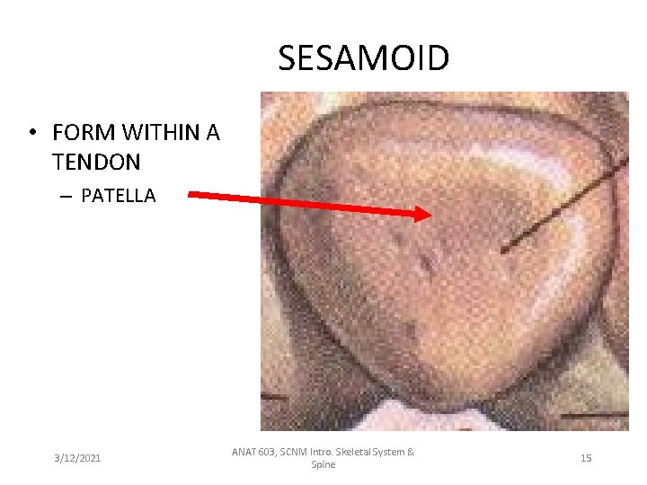 SESAMOID • FORM WITHIN A TENDON – PATELLA 3/12/2021 ANAT 603, SCNM Intro. Skeletal