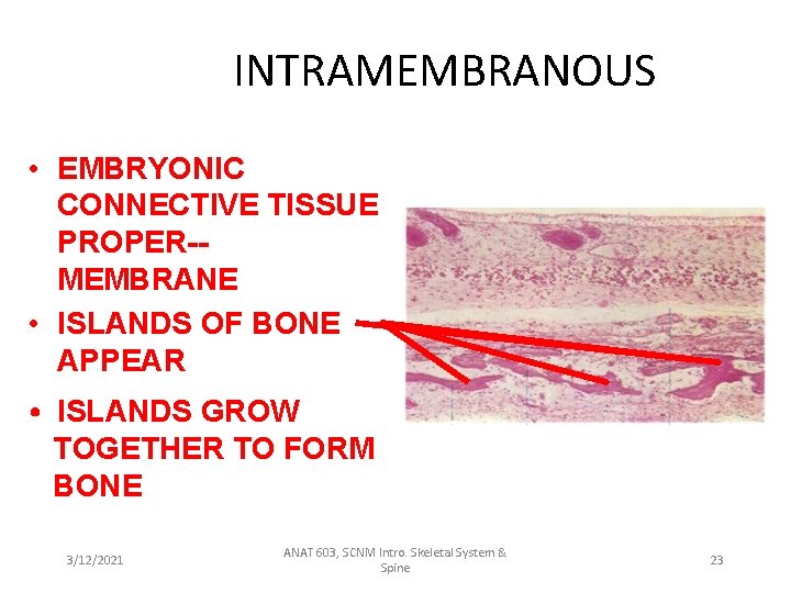 INTRAMEMBRANOUS • EMBRYONIC CONNECTIVE TISSUE PROPER-MEMBRANE • ISLANDS OF BONE APPEAR • ISLANDS GROW