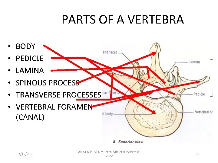 PARTS OF A VERTEBRA • • • BODY PEDICLE LAMINA SPINOUS PROCESS TRANSVERSE PROCESSES