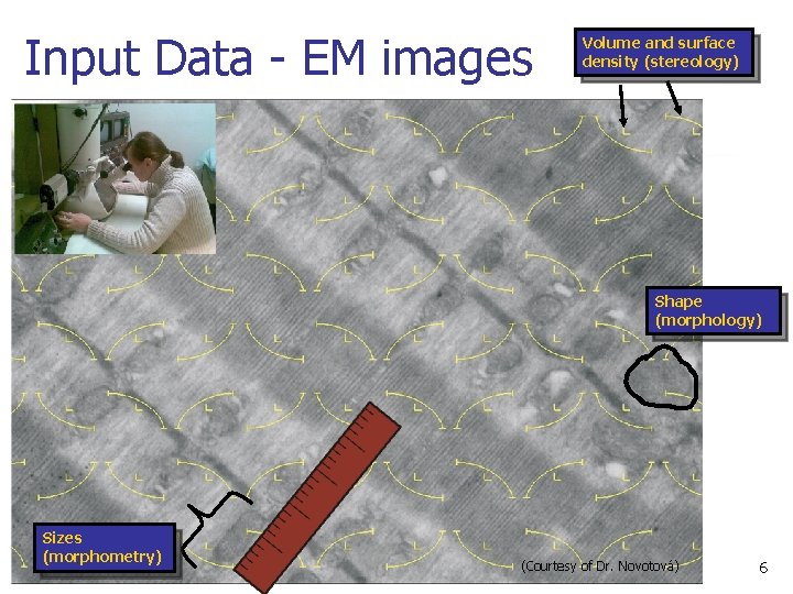 Input Data - EM images Volume and surface density (stereology) Shape (morphology) Sizes (morphometry)