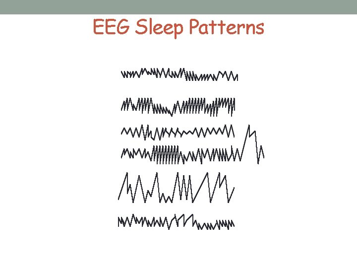 EEG Sleep Patterns 