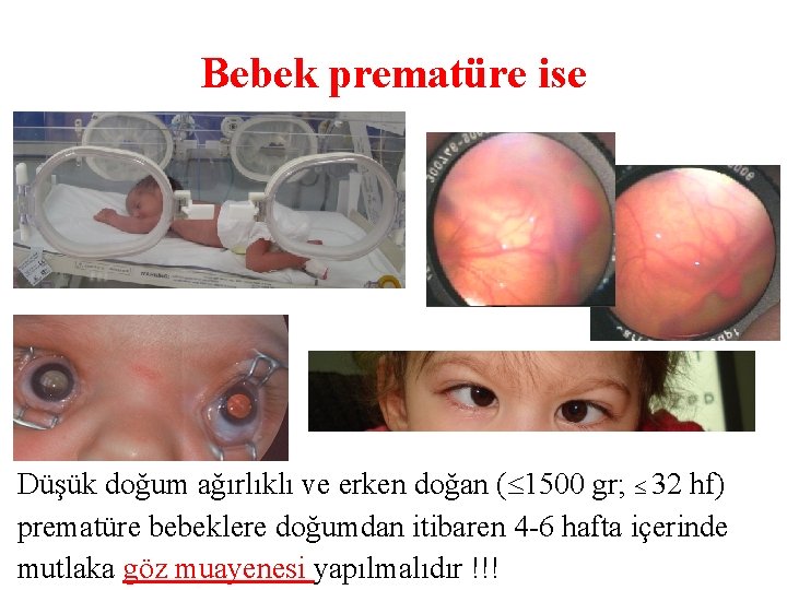 Bebek prematüre ise Düşük doğum ağırlıklı ve erken doğan ( 1500 gr; 32 hf)