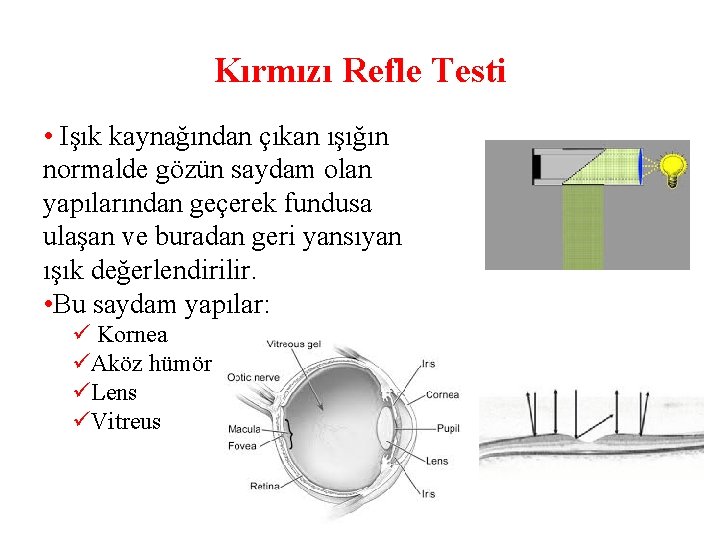 Kırmızı Refle Testi • Işık kaynağından çıkan ışığın normalde gözün saydam olan yapılarından geçerek