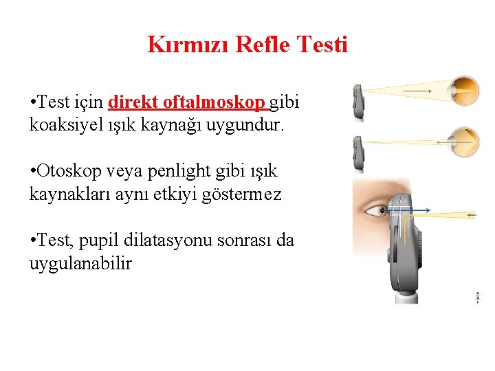 Kırmızı Refle Testi • Test için direkt oftalmoskop gibi koaksiyel ışık kaynağı uygundur. •