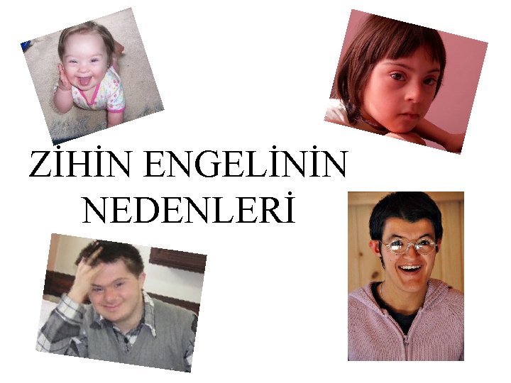 ZİHİN ENGELİNİN NEDENLERİ 