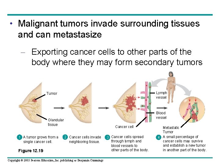  • Malignant tumors invade surrounding tissues and can metastasize – Exporting cancer cells
